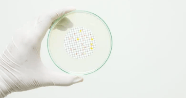 Hand displaying a petri dish tested with GVS Malaysia's bacterial filter.