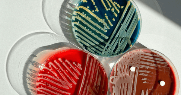 Colorful microbial count plates by GVS Malaysia, used for analyzing bacterial growth in lab settings.